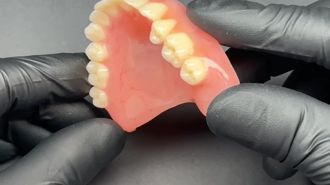 Complete Maxillary Denture