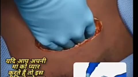 Baby birth by operation,full animation video