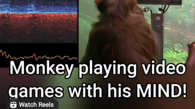 Neuralink brain chip