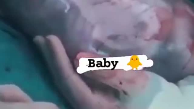 Doctor_status || Baby _Born_video||