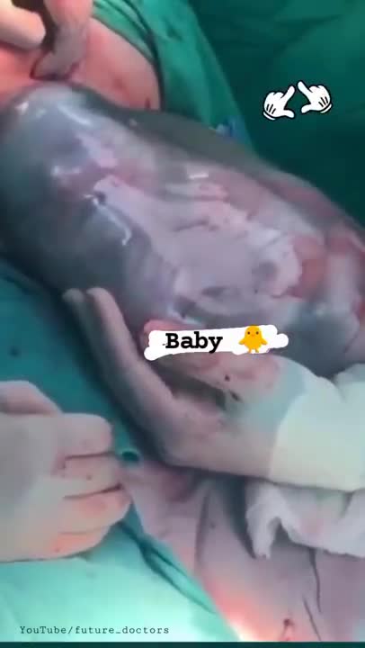 Doctor_status || Baby _Born_video||