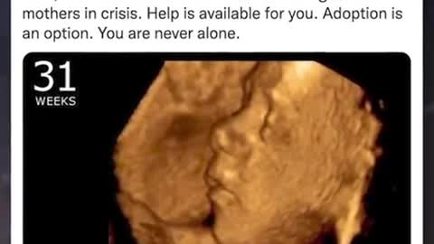 South Dakota Just Closed its Last Abortion Clinic