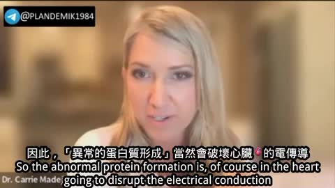 Dr. Carrie Madej 解釋 「澱粉樣變性」、疫苗注射的粘著的水凝膠和刺突蛋白，與 EMF 電磁場對人體的交互影響。