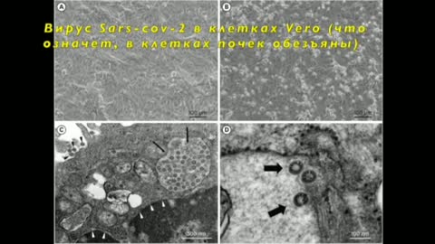 2021-10-31 Фото дельта-штамма коронавируса - фейк