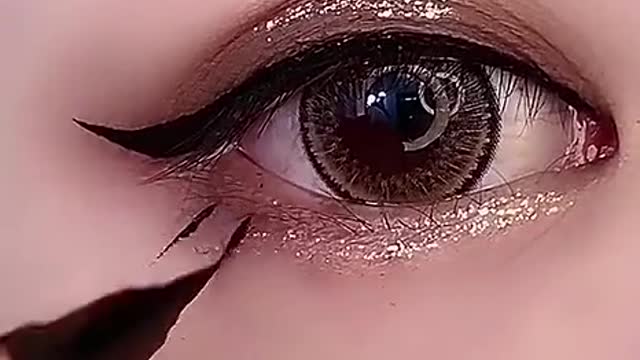 Eye