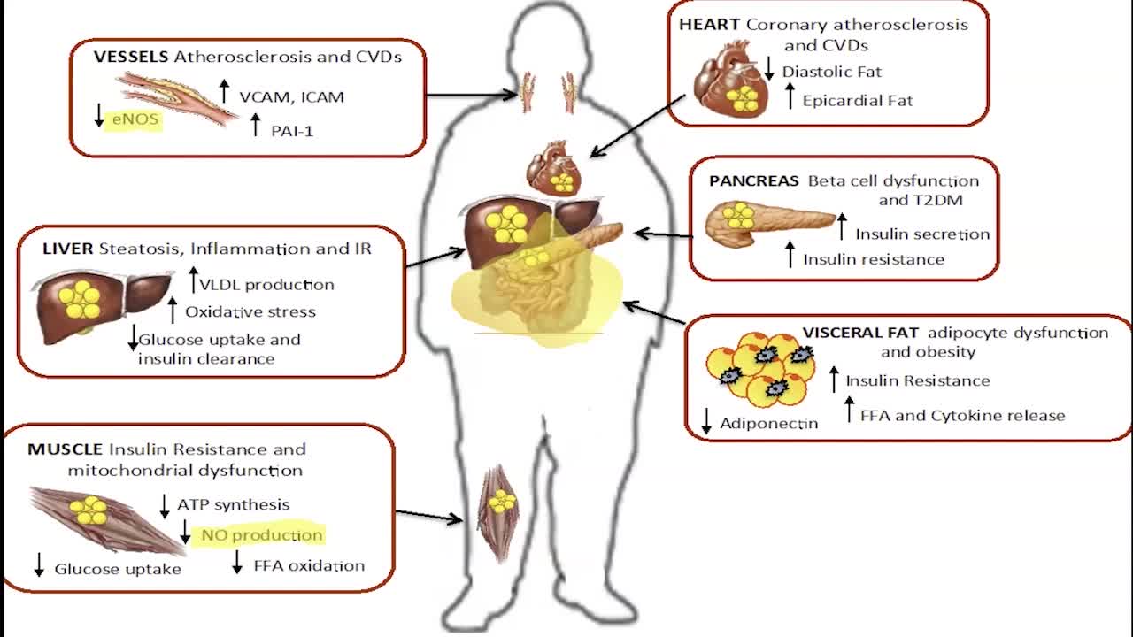 Statins Will Make You Less Likely To Die From Heart Disease But More Likely To Die From Stroke