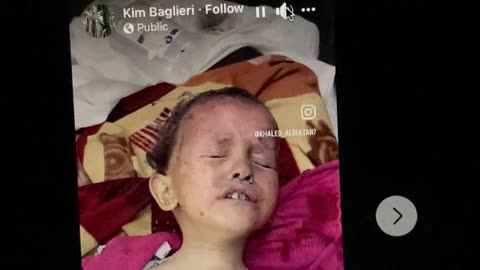 Israel burning children