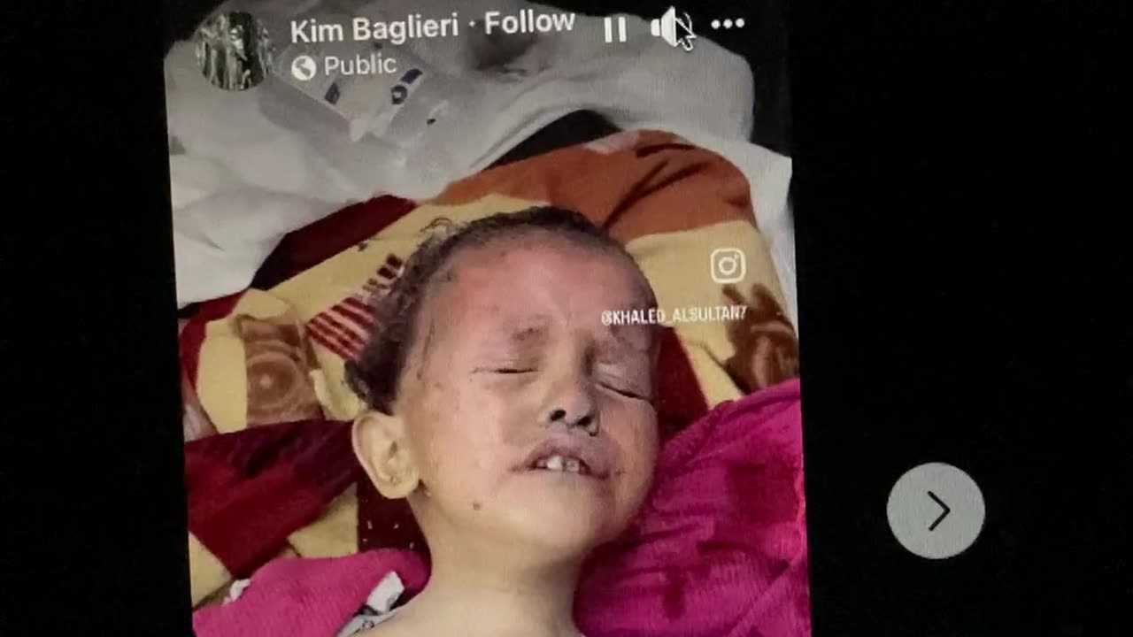 Israel burning children