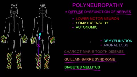 Polyneuropathy