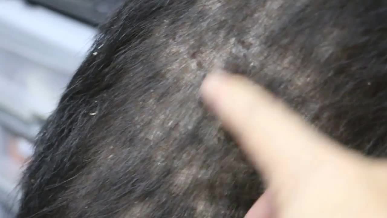 Skin disease - A 12-year-old dog has both backsides hairless and an ear haematoma mp4