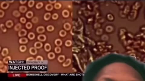 This Is Why You Cant Give Blood