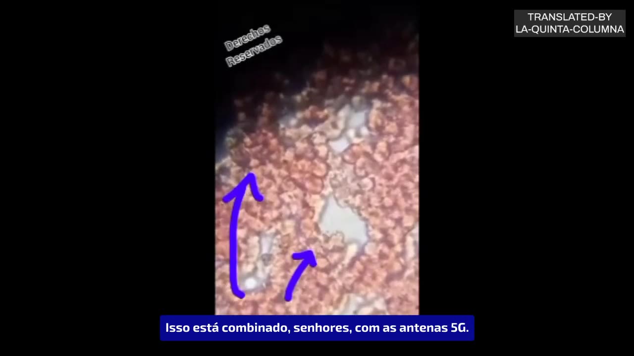 MAIS UMA AMOSTRA DO QUE AS VACINAS FAZEM NAS PESSOAS