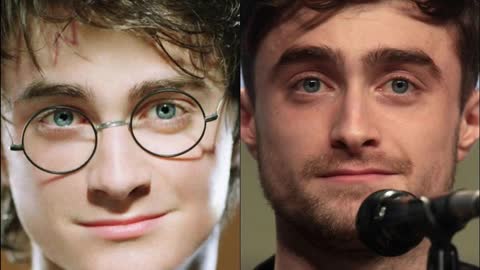 10 stars de Harry Potter (avant et après)