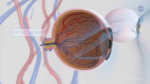 NASA (vision changes in space)