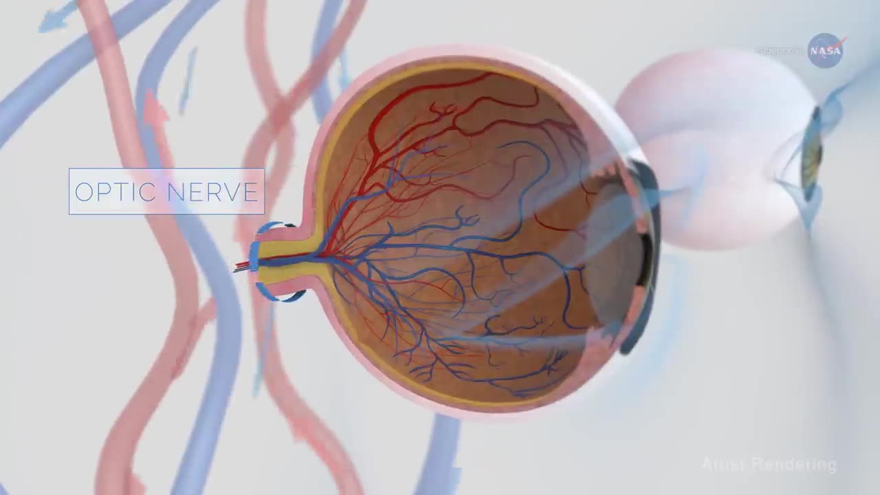 NASA (vision changes in space)