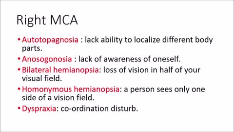 Middle cerebral artery stroke | signs and symptoms.