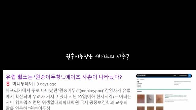 원숭이두창이 아니라 에이즈!!!! 천연두 백신을 위해 엄청난 사실들을 숨기고 있다.