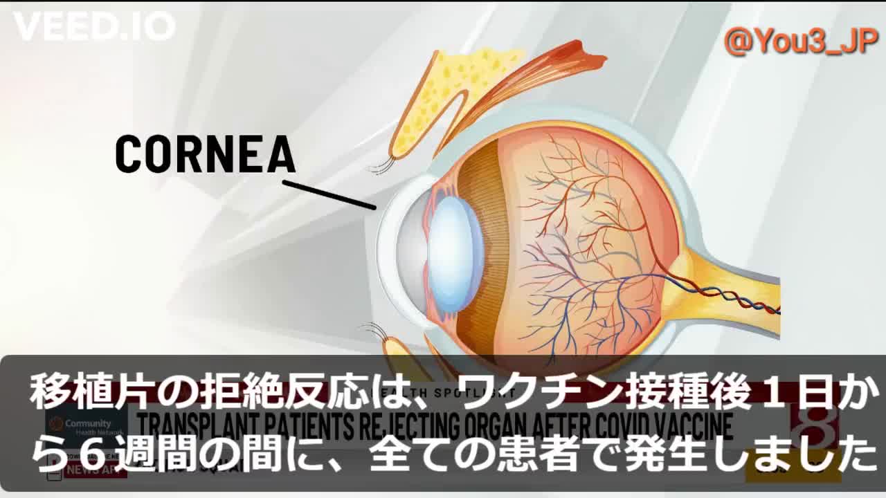 日本の研究者グループからの発信なのに。「日本メディアは無視している」「角膜移植した全員が、ｍRNA薬物による拒絶反応」米国メディアが疑問視して報道。