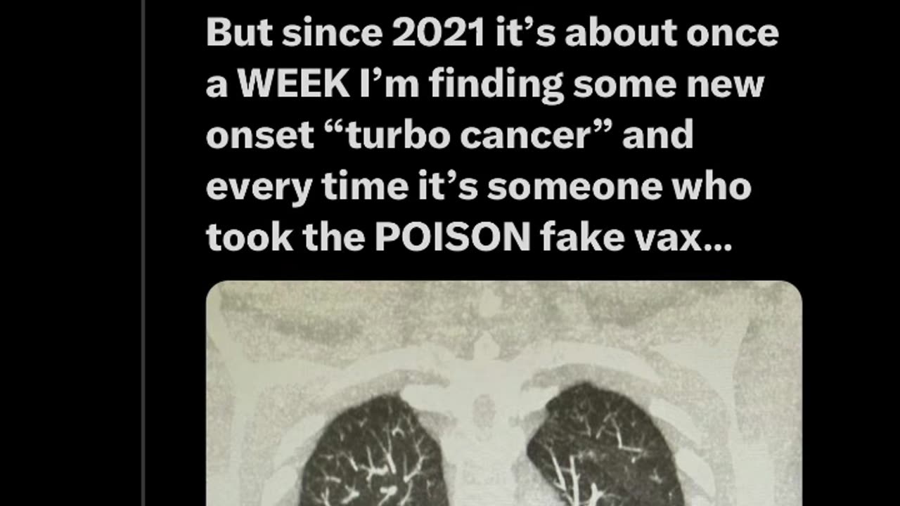 Since 2021 it's I'm finding some new onset "turbo cancer" and every time it's someone who took the💉