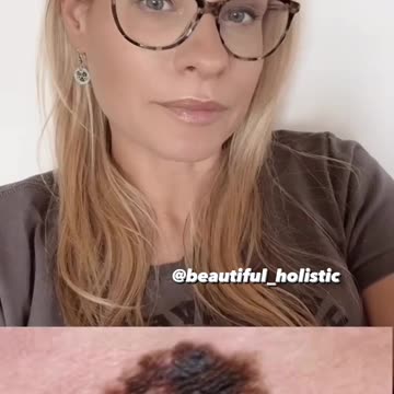 Benefits of Nigella Sativa