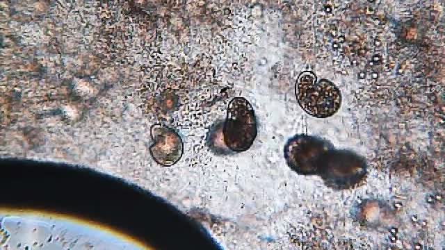 Paramecium feast, 2022-09-28