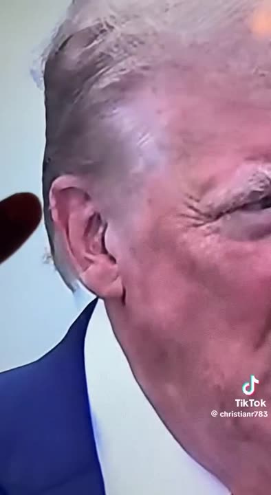 Trump’s Ear