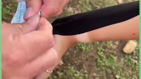 Hypnotic Ankle Taping