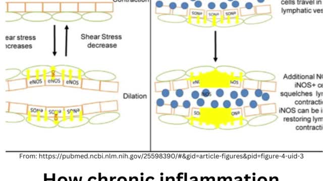 Chronic Inflammation and its impact on lymph flow