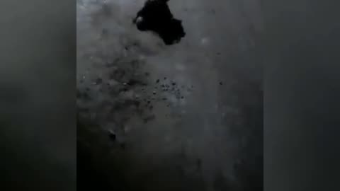 Ukraine Russia War Solider Leaves Loses Foot