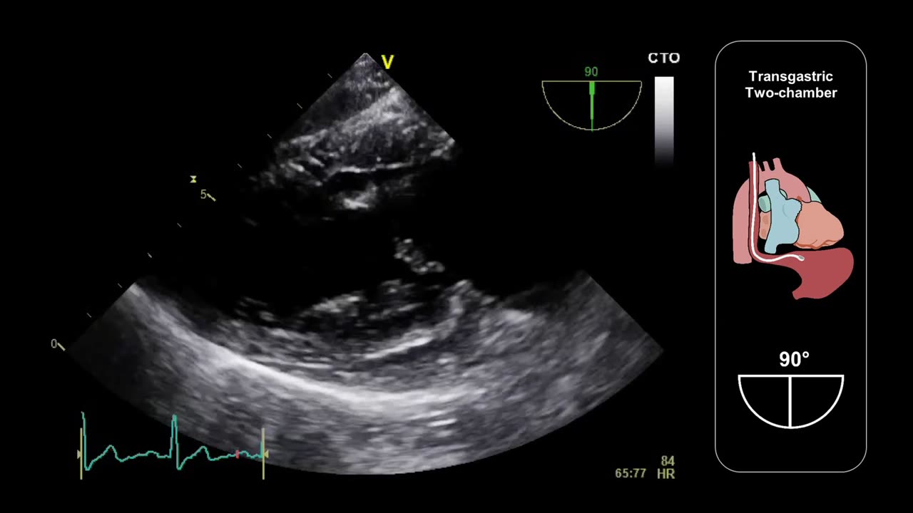 02. 05 How the get views quiz