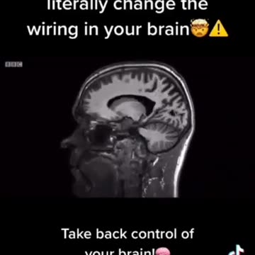 Processed Foods Literally Change How Your Mind Maps Itself - But Doesn't Stop There...