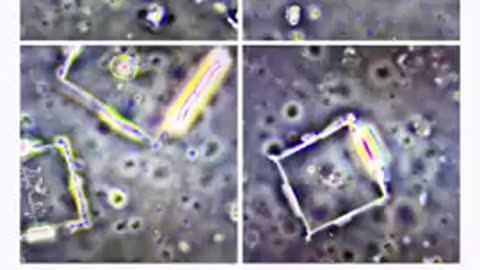 ALL DENTAL NUMBING AGENTS HAVE NANOTECHNOLOGY with Eden's LivingTV