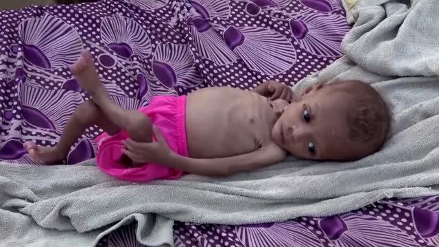 Aid groups in Yemen look to step up aid during ceasefire