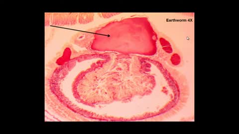 Earthworm Cross Section_Cut