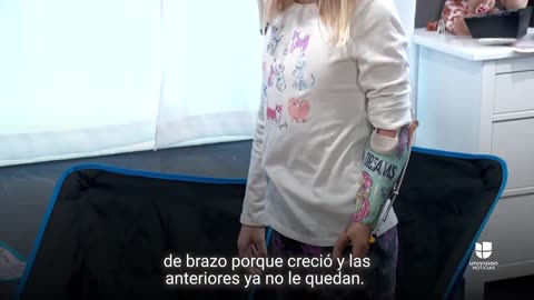 Esta niña necesita una nueva prótesis de brazo, pero su aseguradora dice que no es esencial