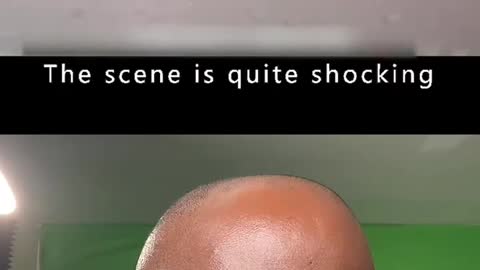 Mosquito burgers anyone?😳🤢🤮