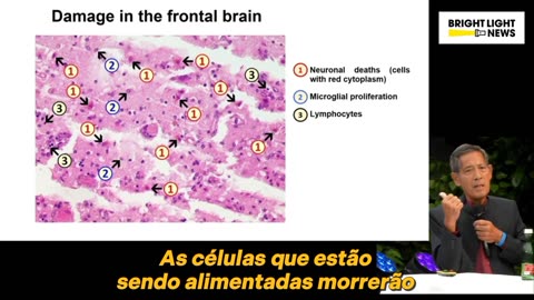 Anatomia de uma lesão pela inoculação covid