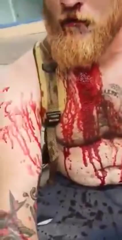 Red Bearded White Man Survives Muslim Defence League Child Rapist Stabbing With Beating!