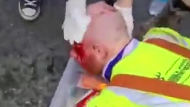 Patriots Get Bloodied While Trying To Help Cars Get Through Black Lives Matter Mob