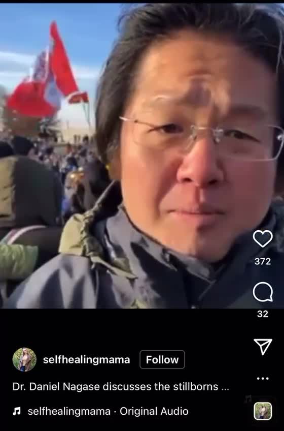 Dr. Nagase discusses stillborn babies
