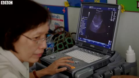 Parasites leading to liver cancer