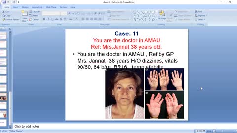 ST5.38 year old lady with dizziness BP 90-60.mp4