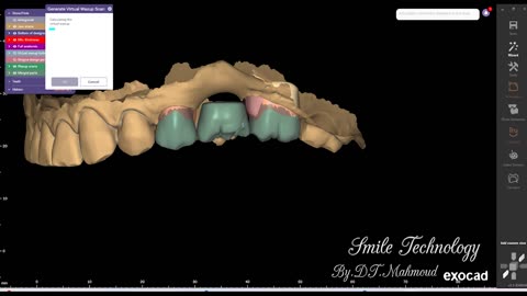 #design #naildesign #dental #dentaldesign #exocadexpert