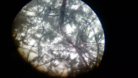 Morgellons in dust
