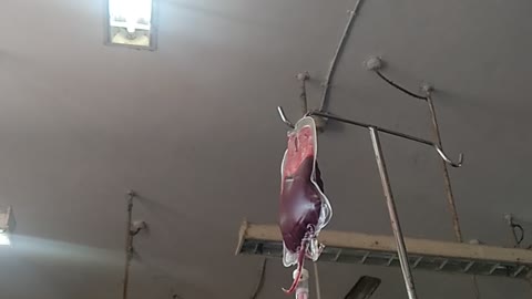 BLOOD TRANSPLANT IN HOSPITAL