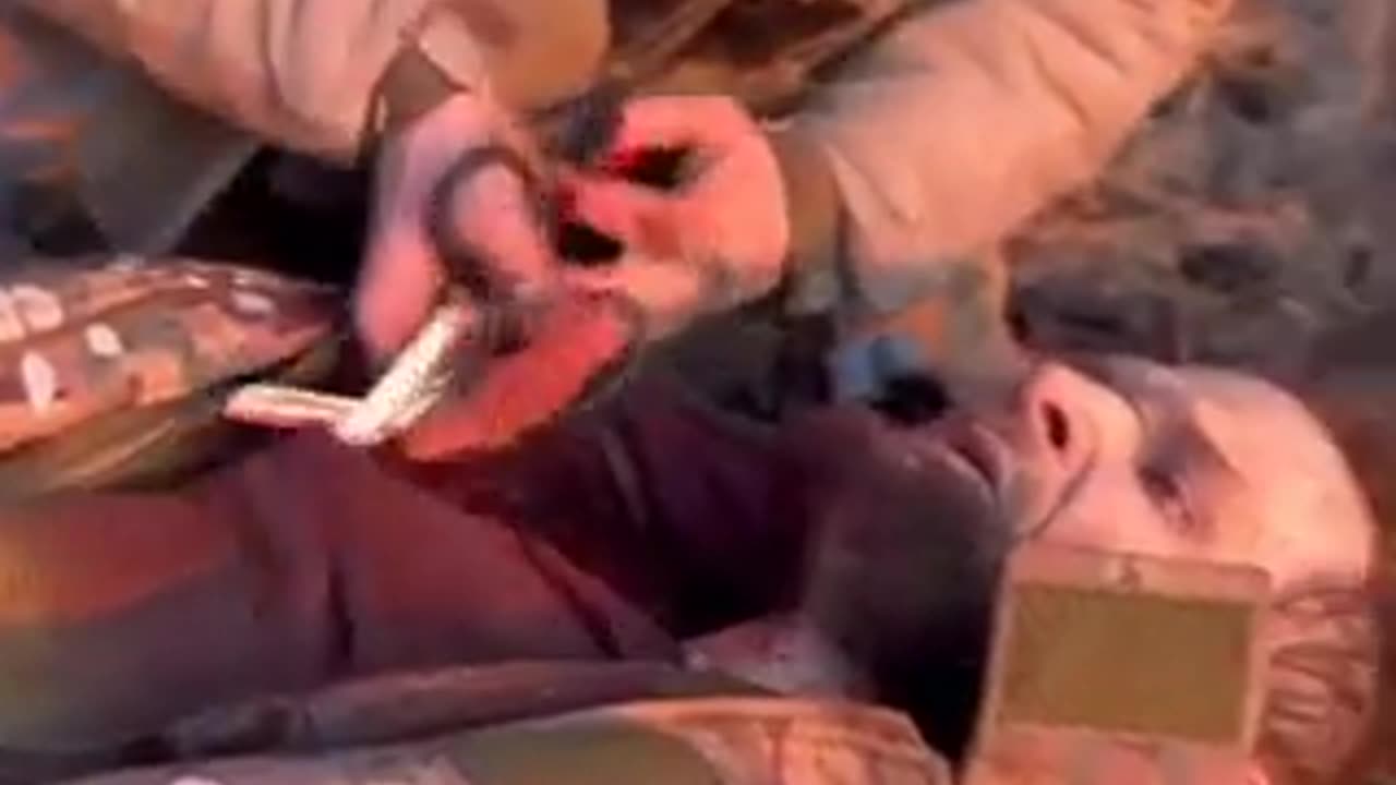 A SERIOUSLY WOUNDED ARMED FORCES OF UKRAINE SOLDIER SCREAMS - A FRAGMENT HAS PIERCED HIS LUNG