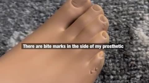 My dog chewed my prosthetic foot!