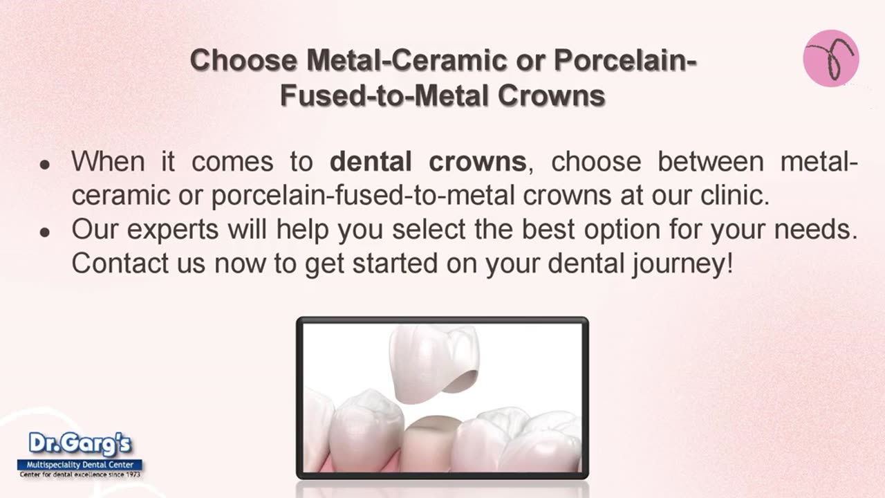 Top-Notch Dental Crowns in Delhi