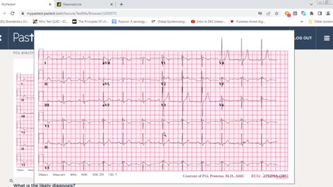 Pastest MRCP II Cardiology 5