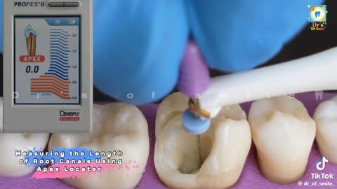 That's why I like dentistry ♥️♥️